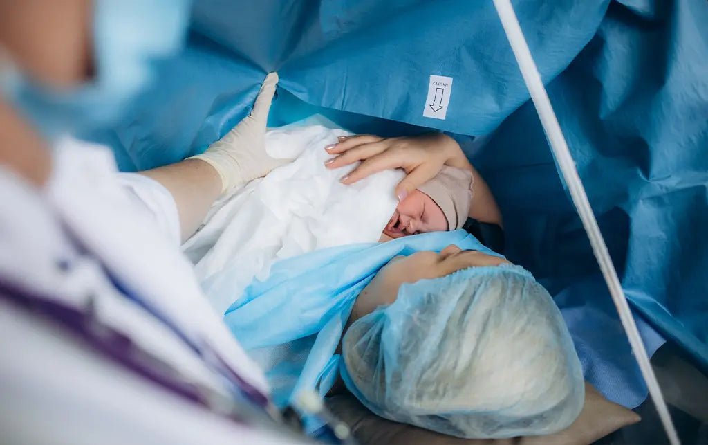 C-Sections: What Do I Need to Know?